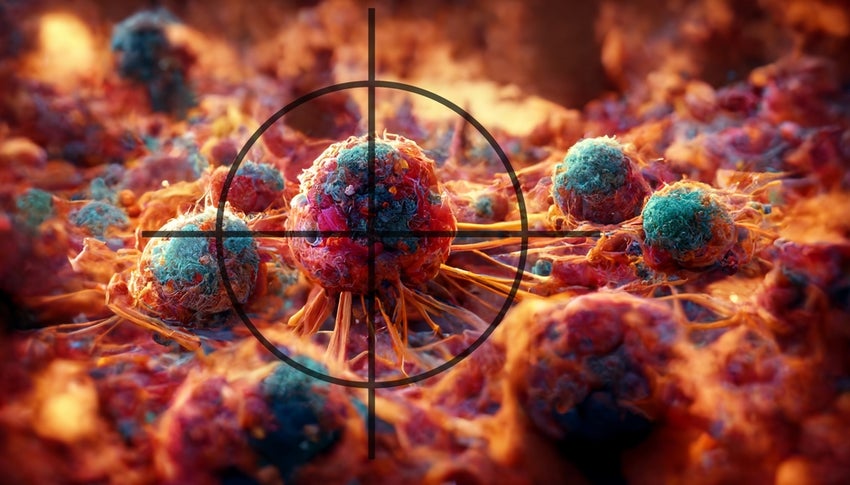 A,3d,Illustration,Depicting,Cancer,Cells,In,The,Crosshairs,,Related