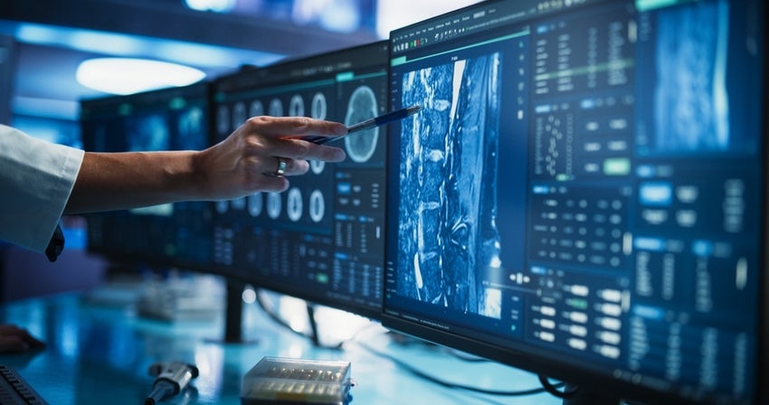 Researcher pointing at desktop computer monitor with scan of human brain and throat.